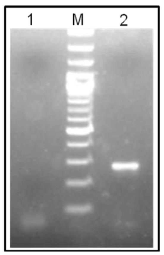 بیان mRNA گیرنده عملکردی لپتین