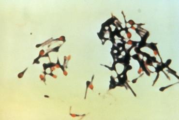 تصویر میکروسکوپی کلستریدیوم تتانی پس از رنگ‌آمیزی.