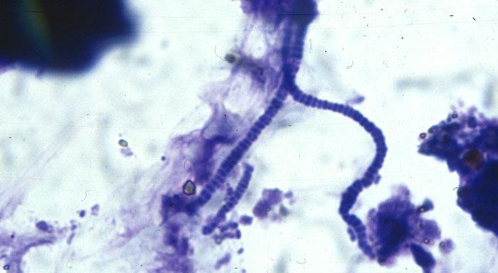 نمای میکروسکوپی باکتری Dermatophilus congolensis در نمونه پوستی