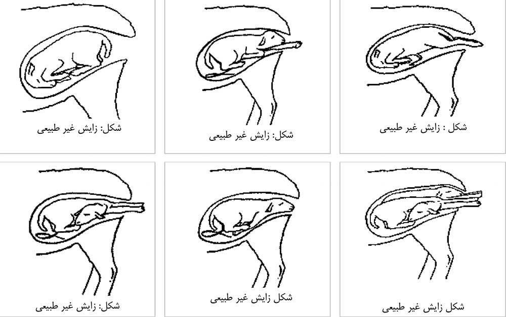 حالت غیرطبیعی جنین در رحم