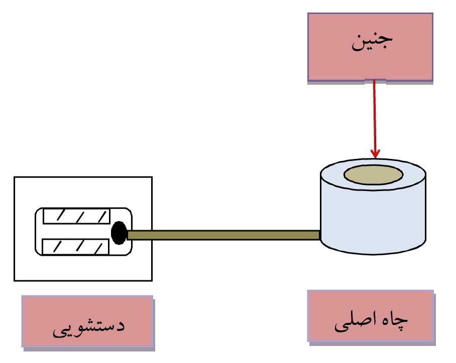 سوزاندن یا دفن کردن جنین‌