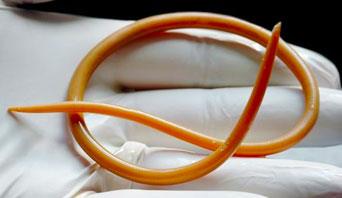 انگل گرد بزرگ large roundworms در اسب