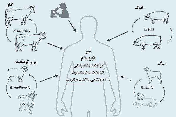 علائم تب مالت در انسان