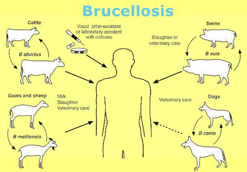 بیماری تب مالت یا بروسلوز